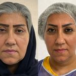 مرکز پوست و مو و لیزر دکتر مهتاب رضوی