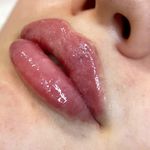 کلینیک زیبایی خانم محمدرضایی پوست ومو