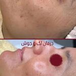 خدمات تخصصی فیشال و پاکسازی