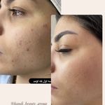 مرکز لیزر ،پوست و زیبایی کندی بیوتی