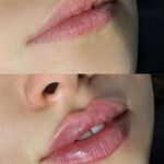 کلینیک زیبایی هانیل