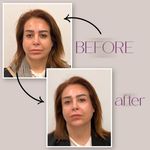 کلینیک زیبایی دکتر عباس مقیمی⚡️۵۰٪ تخفیف