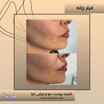 مطب پوست مو زیبایی فردوس شرق
