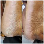 خدمات تخصصی پدیکور درمانی شیوا