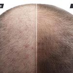 مرکز لیزر و کلینیک زیبایی آسمان پرند