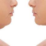 مرکز لیزر و کلینیک زیبایی آسمان پرند