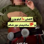 مرکز لاغری موضعی و ایکس بادی فیت اسمارت