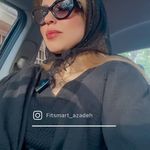 مرکز لاغری موضعی و ایکس بادی فیت اسمارت