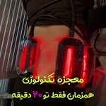 مرکز لاغری موضعی و ایکس بادی فیت اسمارت