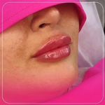 کلینیک زیبایی و لیزر ابریشم