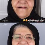 دکتر زهرا راستگو . متخصص لثه و ایمپلنت