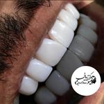 کلینیک دندان پزشکی و ایمپلنت الیسو