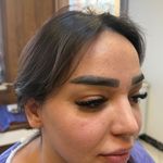کلینیک زیبایی الینا رز