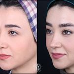 دکتر بهروز جلالی (جراحی بینی لیفت صورت)