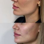 کلینیک پوست و زیبایی ژیلاوَش