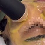 آموزش پاکسازی وفیشیال تخصصی