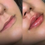 کلینیک لیزر و  زیبایی ملیح