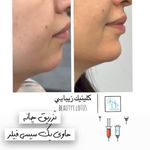 کلینیک پوست و مو و لیزر نیلوفر آبی