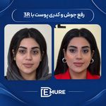 کلینیک زیبایی و جوانسازی دمور