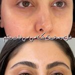 کلینیک زیبایی و لیزر هیرا