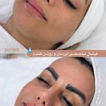 کلینیک فیشال و ماساژ سارن اسکین سارا