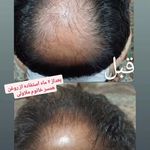 فروش محصولات گیاهی و درمانی نیوشا