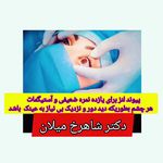چشم‌پزشک جراحی چشم دکتر میلان