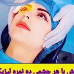چشم‌پزشک جراحی چشم دکتر میلان