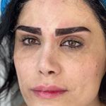 مرکز کاشت ابرو ریحانا در کرج