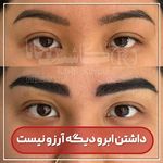 مرکز کاشت ابرو ریحانا در کرج
