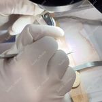 مرکز کاشت ابرو ریحانا در کرج