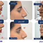 کلینیک زیبایی الین