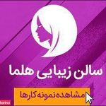 زیبایی حلما