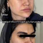 کلینیک آیلی