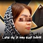 مرکز تخصصی کاشت مو و ابرو بهبد کرج