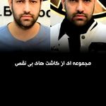 مرکز تخصصی کاشت مو و ابرو بهبد کرج