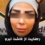 مرکز تخصصی کاشت مو و ابرو بهبد کرج