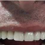 دندانسازی غفاری