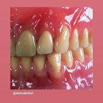 دندانسازی غفاری