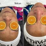 خدمات تخصصی پاکسازی پوست و فیشال شیلوکس