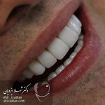 دندانپزشکی زیبایی اسمایل اسپا