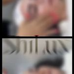 خدمات تخصصی پاکسازی پوست و فیشال شیلوکس