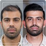 کلینیک پوست مو و زیبایی نوین ایرانا