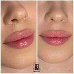 مرکز لیزر کلینیک زیبایی ماساژ گلاریس