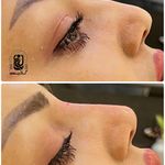 مرکز لیزر کلینیک زیبایی ماساژ گلاریس