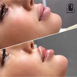 مرکز لیزر کلینیک زیبایی ماساژ گلاریس