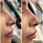 مرکز لیزر کلینیک زیبایی ماساژ گلاریس