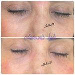 مرکز لیزر کلینیک زیبایی ماساژ گلاریس