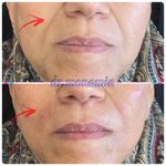 مرکز لیزر کلینیک زیبایی ماساژ گلاریس