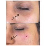 مرکز لیزر کلینیک زیبایی ماساژ گلاریس